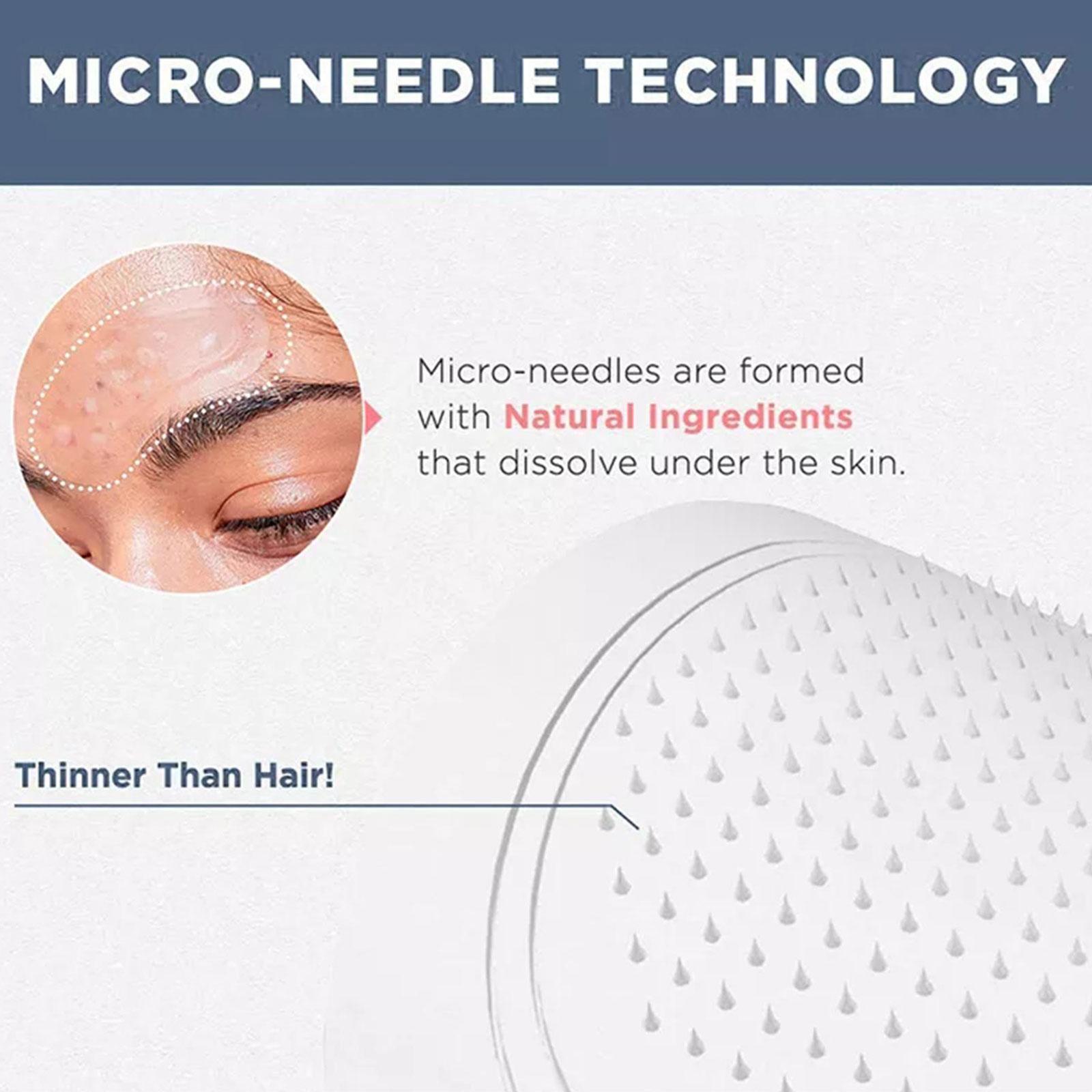 0.2mm Micro-needle Eye Patch M - đánh giá và giá Eye Pad Collagen